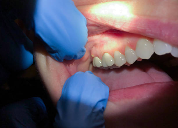 Best Emergency Treatment for Jaw Pain or Injury in Mountain Home Af, ID